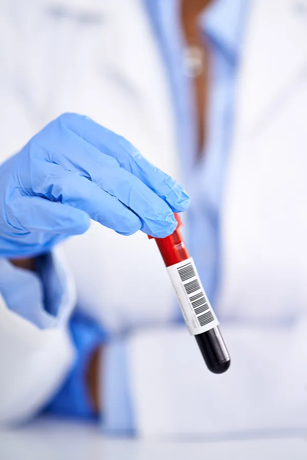 High-Cholesterol-Treatment Close-up of a gloved clinician holding a blood test. Get treatment for high cholesterol from Anita Petruzzelli, M.D. in Glastonbury.