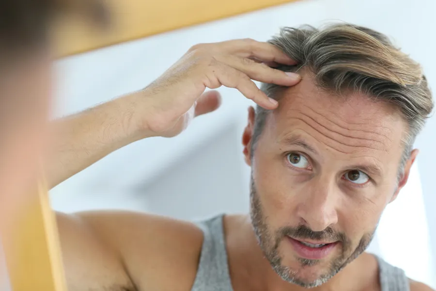 Peptides-for-Hair-Restoration-Doctor A middle-aged man with blonde and gray hair inspects his receding hairline in the mirror, considering getting peptides for hair restoration treatments from Anita Petruzzelli, M.D. in Glastonbury.