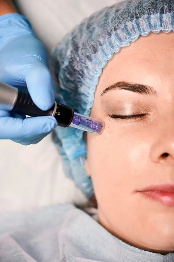 Peptides-for-Skin-and-Aesthetics-Treatment A woman receiving peptide therapy to her face. Get peptides for Skin and Aesthetics from Anita Petruzzelli, M.D. in Glastonbury.